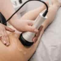 RF-лифтинг (тело)